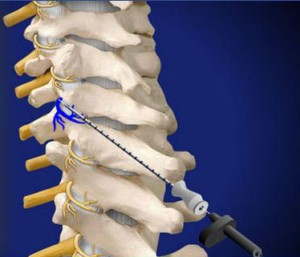 Head, Neck and Spine Pain Treatments Jacksonville & Tampa, FL ...